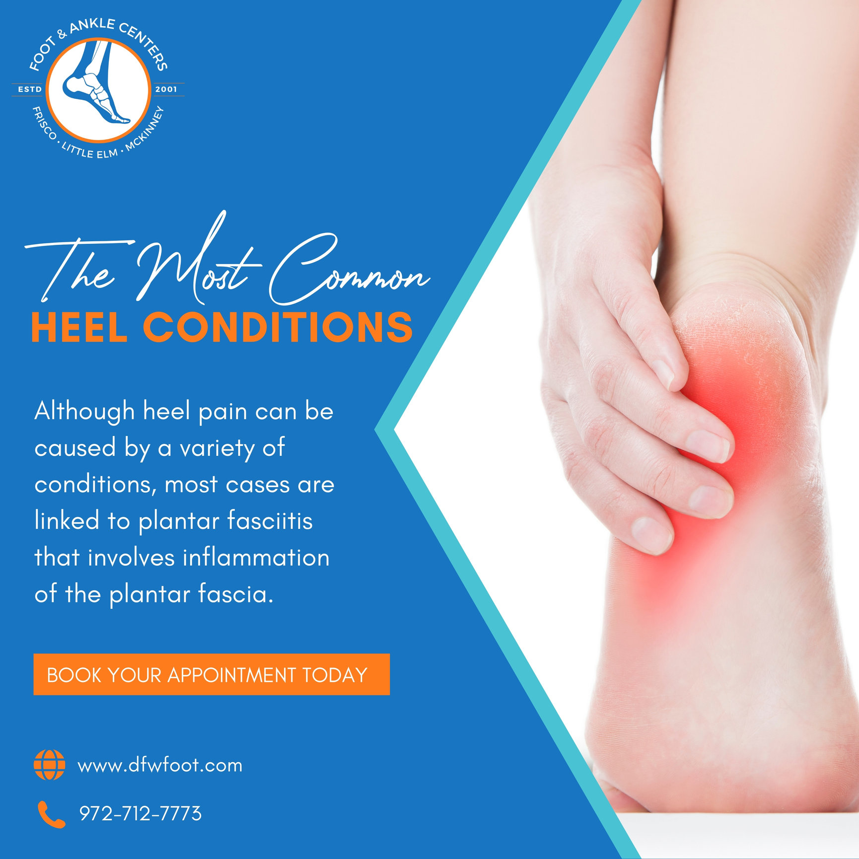 Most Common Heel Condition and Treatment in Frisco, Little Elm, and ...