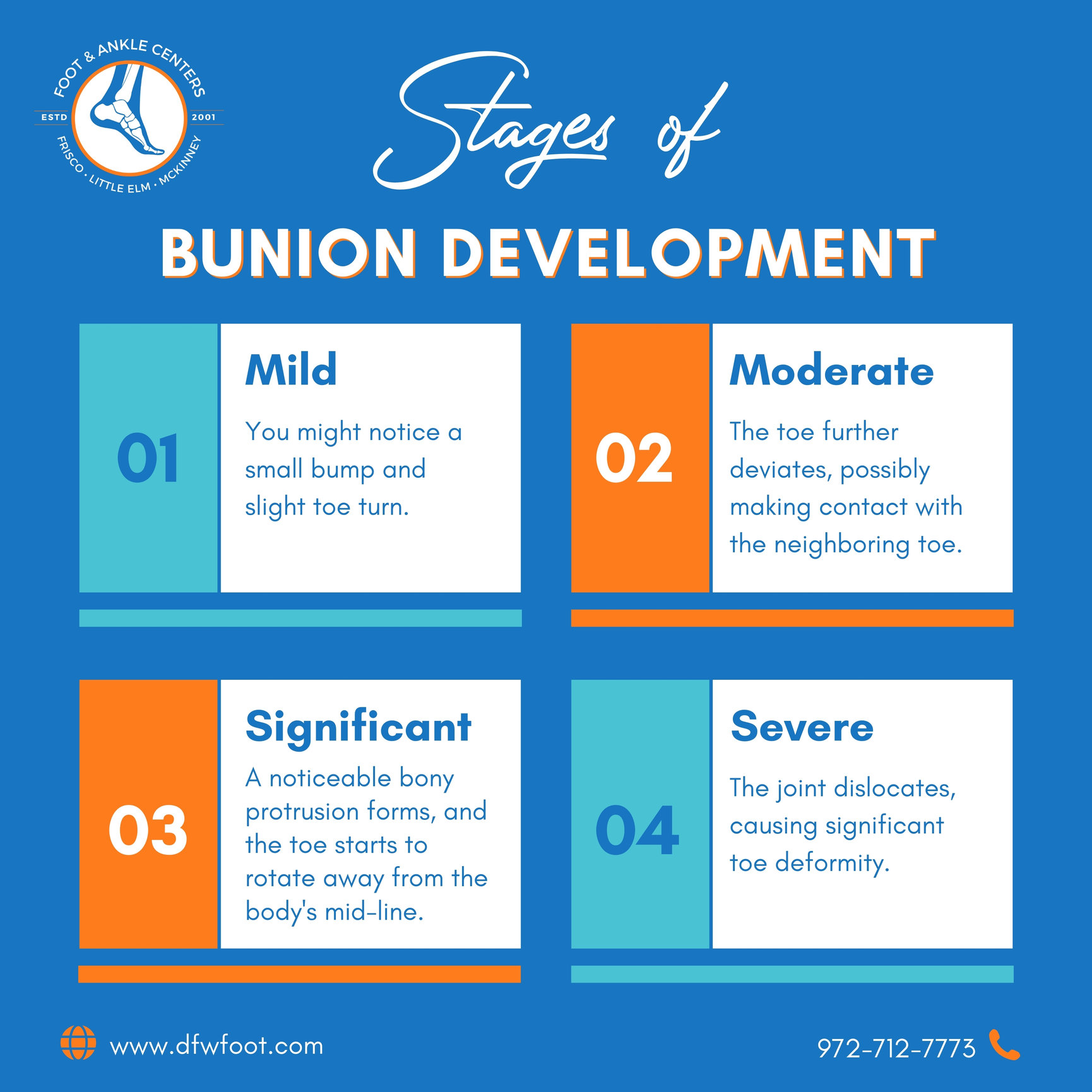 Stages of bunion development in Frisco, Little Elm, and McKinney - Foot ...